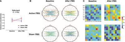 The Effects of Intermittent Theta Burst Stimulation on Functional Brain Network Following Stroke: An Electroencephalography Study